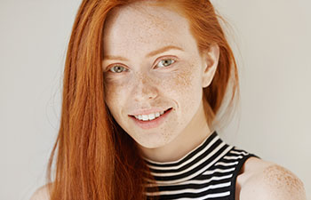 Beautiful young redhead girl with perfect smile. Orthodontists in Marietta GA.