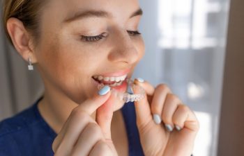 Close-up smiling woman putting on clear dental aligners for orthodontic treatment. transparent braces for effective bite correction and improved aesthetics.