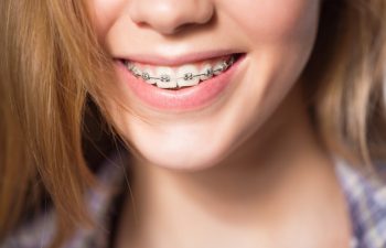Close up portrait of smiling teen girl showing dental braces. Isolated on white background.